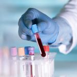 Cancer Screening Funding: Government Programs vs. Private Insurance in the U.S.