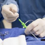 Cosmetic Surgery Skyrockets Among Men—Why Now? Medical professional preparing an intravenous catheter in a sterile setting