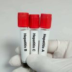 Rugby Star CRUSHED: Shocking 18-Month Doping Ban Gloved hand holding three blood sample tubes with red caps