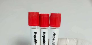 Gloved hand holding three blood sample tubes with red caps